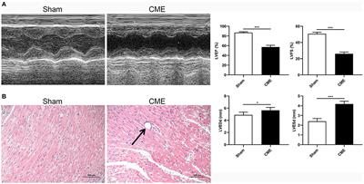 miR-200a-3p Attenuates Coronary Microembolization-Induced Myocardial Injury in Rats by Inhibiting TXNIP/NLRP3-Mediated Cardiomyocyte Pyroptosis